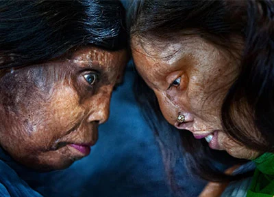 Skin Project